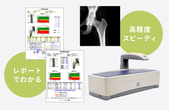 レポートでわかる・高精度スピーディ