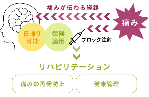 ブロック注射