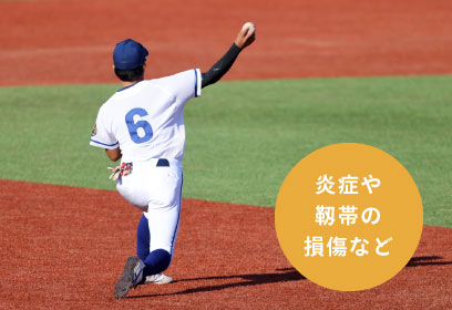 炎症や靱帯の損傷など